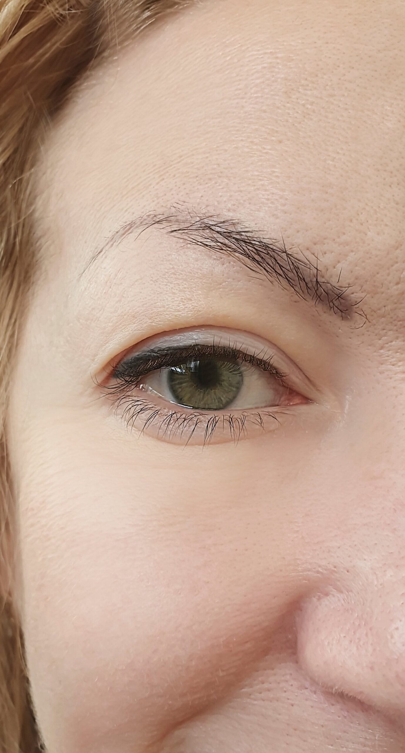 Nova client eye area after