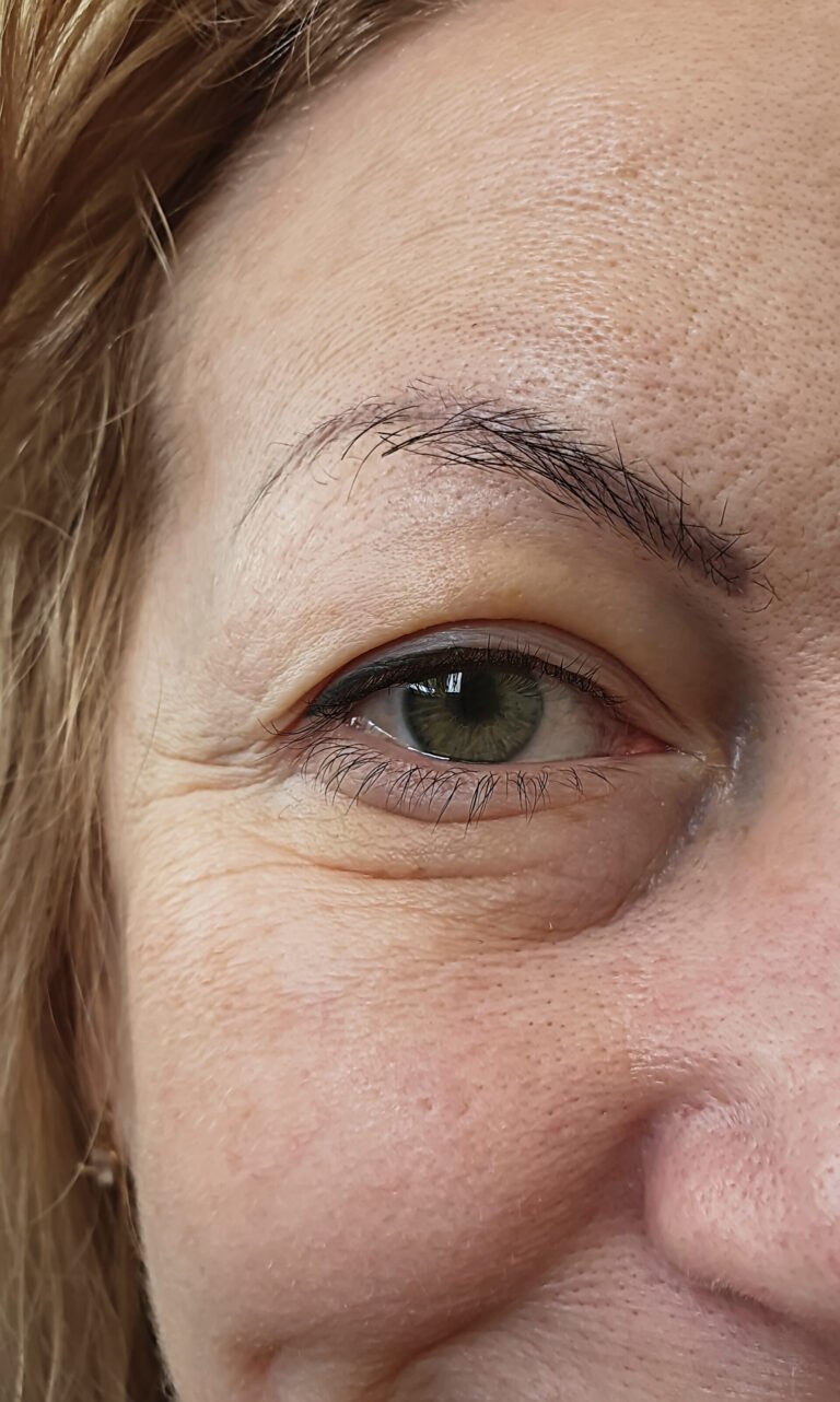Nova client eye area before